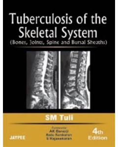 Tuberculosis of the Skeletal System