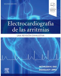 Electrocardiografía De Las Arritmias. Una Revisión Exhaustiva.