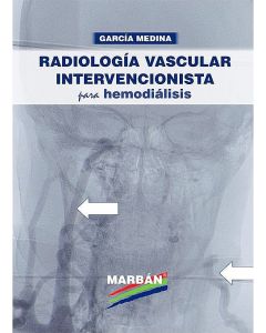 Radiología Vascular Intervencionista Para Hemodiálisis