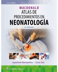 Macdonald Atlas De Procedimientos En Neonatología.