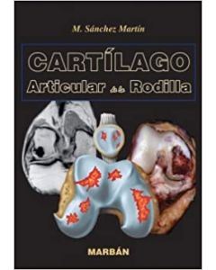 Cartilago Articular De La Rodilla