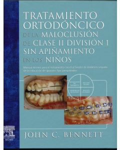 Tratamiento ortodoncico de la maloclusion clase ii