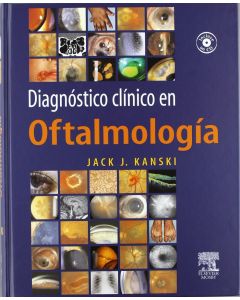Diagnóstico clínico en oftalmología + CD-ROM