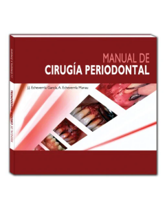 Manual de cirugía periodontal
