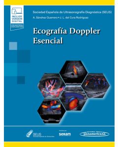 Ecografía Doppler Esencial
