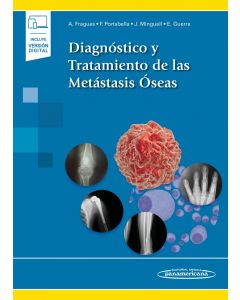 DIAGNÓSTICO Y TRATAMIENTO DE LAS METÁSTASIS ÓSEAS1 ED  (INCLUYE VERSIÓN DIGITAL)