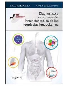 Diagnóstico Y Monitorización Inmunofenotípica De Las Neoplasias Leucocitarias