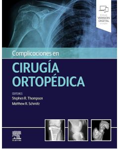 Complicaciones En Cirugía Ortopédica