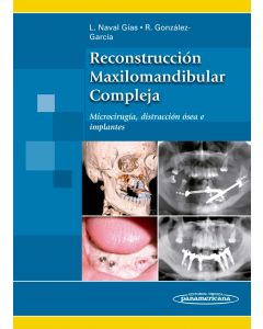 Reconstrucción Maxilomandibular Compleja