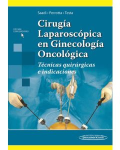 Cirugía Laparoscópica En Ginecología Oncológica