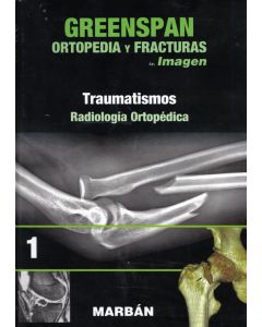Ortopedia Y Fracturas Img, Tomo 2, Artritis