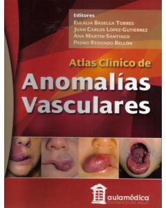 Atlas Clínico De Anomalías Vasculares